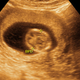 Illustration for article titled Iowa Bill Would Ban All Abortions